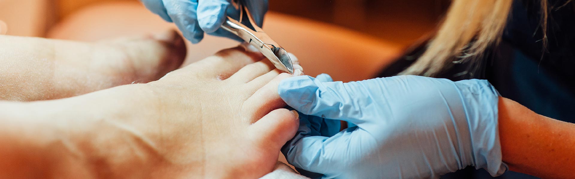 Nails & ingrown toenail treatments